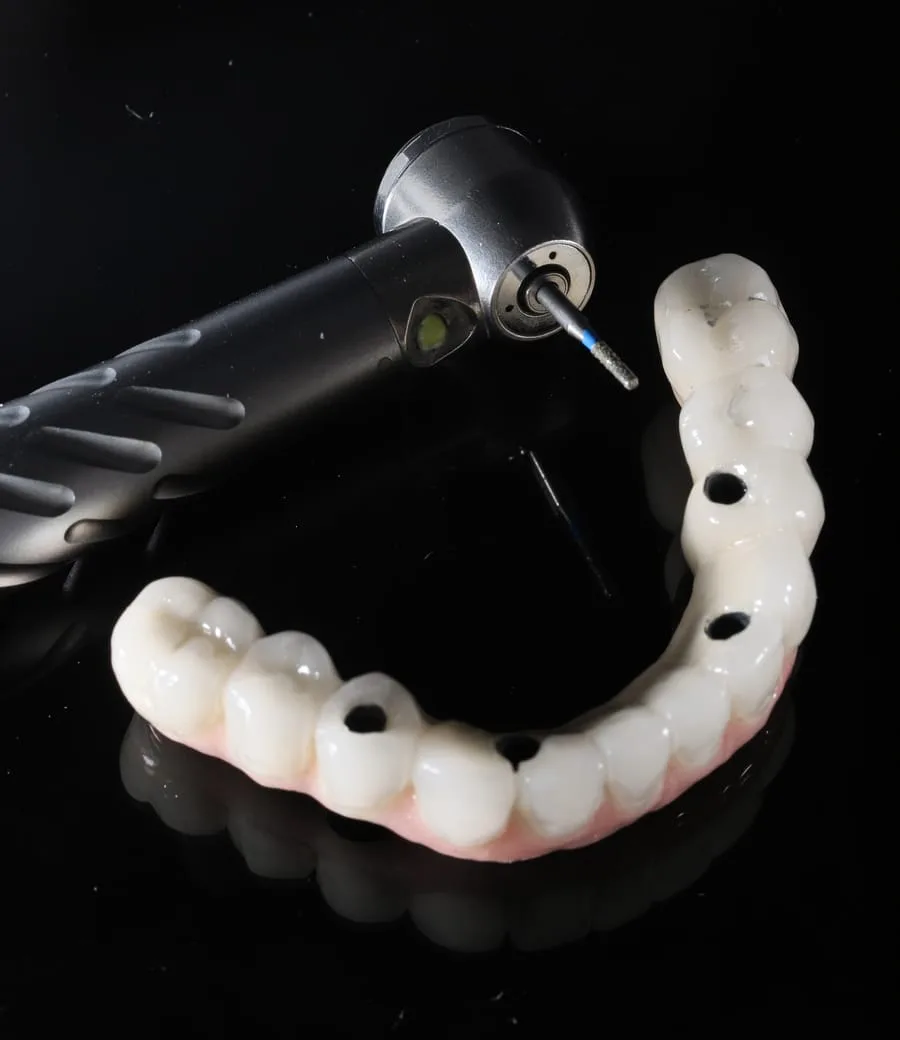All-on-4 Full Arch — treatment illustration